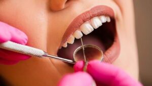 Mengenal Perbedaan Scaling dan Pembersihan Karang Gigi